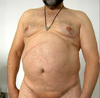 Denis BRUN - Armand - 2009